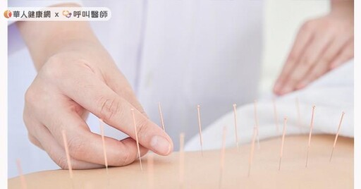 椎間盤突出只能吃止痛藥？吳文誠中醫師：4招治療椎間盤突出，恢復無痛人生