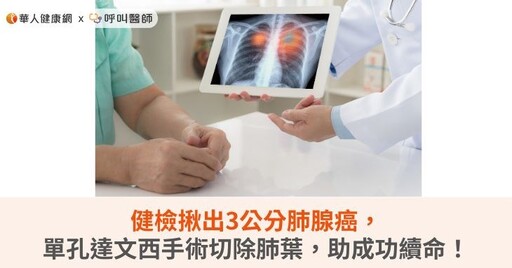 健檢揪出3公分肺腺癌，單孔達文西手術切除肺葉，助成功續命！