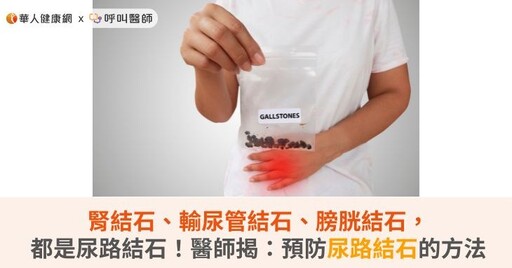 腎結石、輸尿管結石、膀胱結石，都是尿路結石！醫師揭：預防尿路結石方法