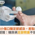 糖尿病小傷口釀足部感染，差點截肢！醫師提醒：糖尿病足部照護不容忽視