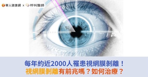 每年約近2000人罹患視網膜剝離！視網膜剝離有前兆嗎？如何治療？