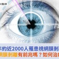 每年約近2000人罹患視網膜剝離！視網膜剝離有前兆嗎？如何治療？