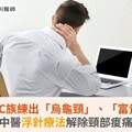 重度3C族練出「烏龜頸」、「富貴包」！中醫浮針療法解除頸部痠痛