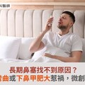 長期鼻塞找不到原因？恐鼻中膈彎曲或下鼻甲肥大惹禍，微創治療復原快