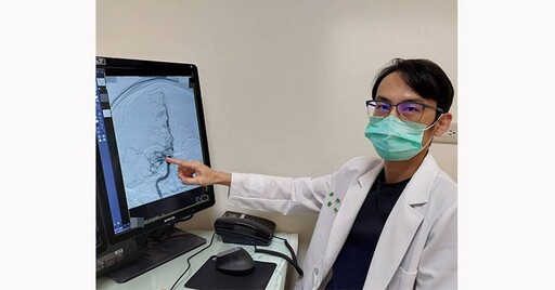 搶救缺血型腦中風，「取栓手術」救命！醫籲：牢記辨別中風口訣FAST