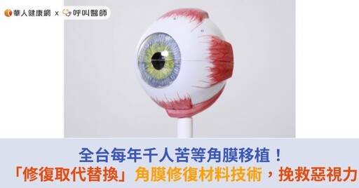 全台每年千人苦等角膜移植！「修復取代替換」角膜修復材料技術，挽救惡視力