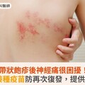 帶狀皰疹後神經痛很困擾！醫籲：接種疫苗防再次復發，提供最佳保護