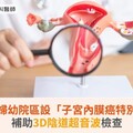 北市聯醫婦幼院區設「子宮內膜癌特別門診」！補助3D陰道超音波檢查