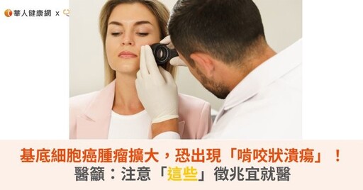 基底細胞癌腫瘤擴大，恐出現「啃咬狀潰瘍」！醫籲：注意2徵兆防皮膚癌上身