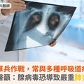 腺病毒非單兵作戰，常與多種呼吸道病毒聯手！醫籲：腺病毒恐導致嚴重肺炎