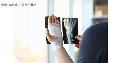 除了三高，更應重視一低（低骨質密度)！「這樣做」防範骨質疏鬆症導致骨折