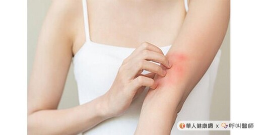 冬天手腳冰冷未必是末梢循環問題!賴睿昕中醫師:紅斑性狼瘡保養5要訣