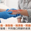 急性擦挫傷、撕裂傷、燒燙傷，照護都一樣？醫揭：不同傷口照顧的差異