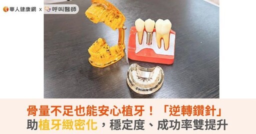 骨量不足也能安心植牙！「逆轉鑽針」助植牙緻密化，穩定度、成功率雙提升