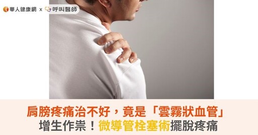 肩膀疼痛治不好,竟是「雲霧狀血管」增生作祟!微導管栓塞術擺脫疼痛