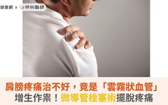 肩膀疼痛治不好，竟是「雲霧狀血管」增生作祟！微導管栓塞術擺脫疼痛