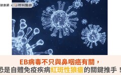 EB病毒不只與鼻咽癌有關，恐是自體免疫疾病紅斑性狼瘡的關鍵推手！