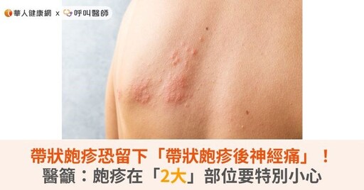 帶狀皰疹恐留下「帶狀皰疹後神經痛」！醫籲：皰疹在「2大」部位要特別小心