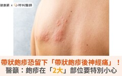 帶狀皰疹恐留下「帶狀皰疹後神經痛」！醫籲：皰疹在「2大」部位要特別小心