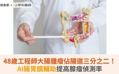 48歲工程師大腸腫瘤佔腸道三分之二！AI腸胃鏡輔助提高腺瘤偵測率