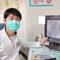 62歲婦血管嚴重鈣化狹窄 心導管冠狀動脈旋磨術成功救治