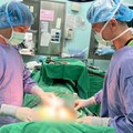 6旬男罹腸癌4年來復發轉移 南投醫院溫熱療法成功克癌