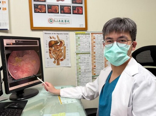 婦健檢意外發現大腸癌前病變 內視鏡黏膜下剝離術免切腸