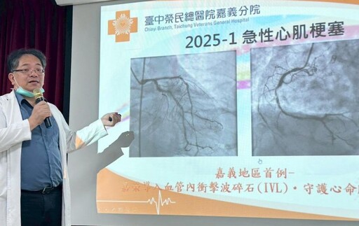 中榮嘉義分院創下嘉義首例震波碎石 輔助支架手術成功患者迎重生