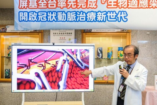 屏基率先全台完成「生物適應架」植入 開啟冠狀動脈治療新世代