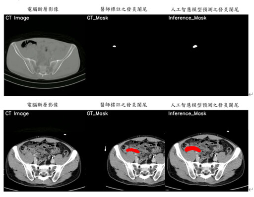 AI助力醫療突破診斷困境！元智攜手亞東榮獲國家新創獎肯定