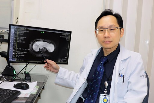 免疫標靶聯合治療為癌友帶來新希望 聯新國際醫院曝延命關鍵
