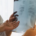 半天就有將近2人遭肺癌奪命，高雄肺癌死亡率高於全台平均！
