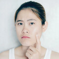 皮膚長小肉芽，是身體健康出問題？醫揭6種「皮膚贅疣」這情況需抽血