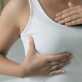 乳頭出血竟是「乳頭內長腫瘤」！醫示警「1狀況」乳癌機率恐增5倍