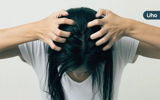 天天洗頭好嗎？為什麼洗完頭還會癢？專家揪頭皮保養「3大隱形兇手」