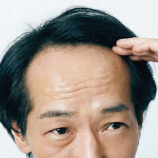 變胖、禿頭⋯好怕旁人嘲笑眼光！心理師教你「2方法」看穿容貌焦慮