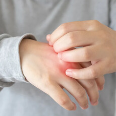 20歲男大生乾癬疾病延燒關節誤認痛風，醫籲提早控制發炎為關鍵