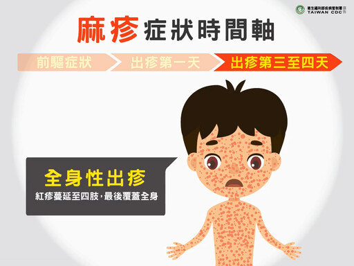 【麻疹懶人包】台灣累計 7 例！症狀與傳染途徑一次看 醫師：「這些人」要留意感染風險