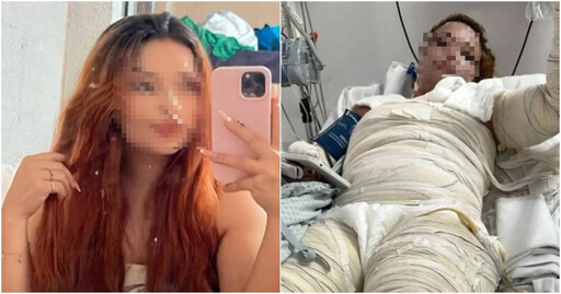 桃色一晚變調!單親媽媽與男伴入住摩鐵「浴缸滑倒」昏迷 全身重度燙傷喪命
