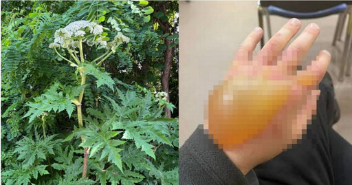 日本北海道驚見「世界第一猛毒植物」 誤觸慘況曝!嚴重恐失明