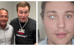 鑽石嵌眼值千萬！23歲珠寶商打造全球最貴義眼 網封「真實版龐德反派」