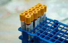 研究：採集一滴血液 可預測十年疾病風險