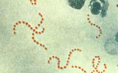 日本「食人菌」爆發…世界各地都有 台大醫示警6類人：死亡風險高