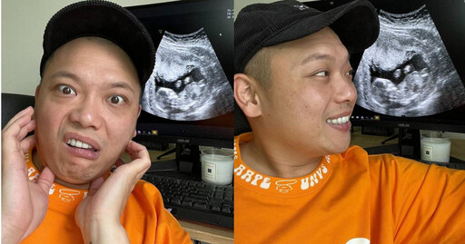 阿虎曬超音波照 證實女友懷孕3個月即將當爸