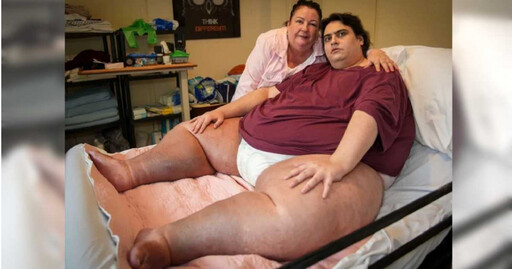 體重317公斤 英國最胖的男人「生日前一周」器官衰竭亡…享年33歲