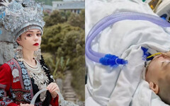 31歲網紅俄羅斯娜娜「酒後吃止痛藥」！ 昏迷38天搶救無效身亡
