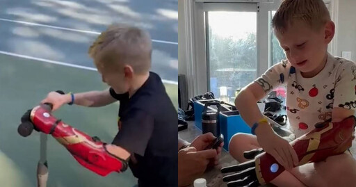 5歲男童裝上「英雄臂」仿生義肢 成為「最年輕鋼鐵人」