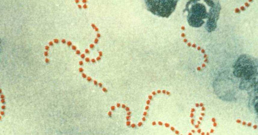 6歲童跌倒感染「食人菌」險截肢 醫示警：其實很常見
