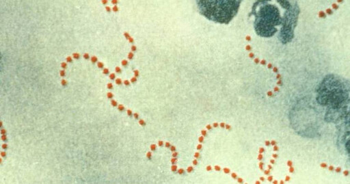 日本爆「食人菌」疫情 前台大醫籲恢復「疫情2習慣」：不用取消行程