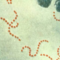 日本爆「食人菌」疫情 前台大醫籲恢復「疫情2習慣」：不用取消行程